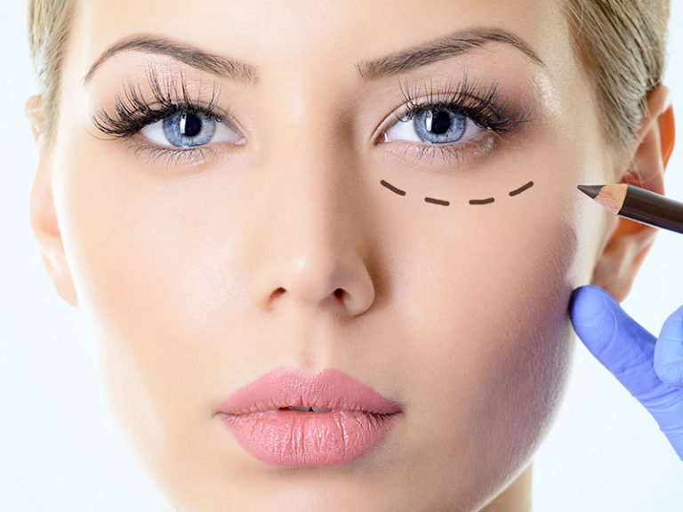 Leia mais sobre o artigo Cirurgia da face com pálpebra